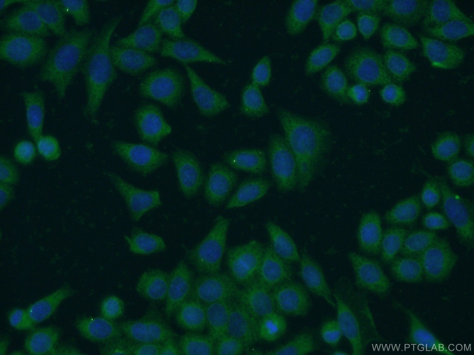 Immunofluorescence (IF) / fluorescent staining of HeLa cells using FN3KRP Polyclonal antibody (16312-1-AP)