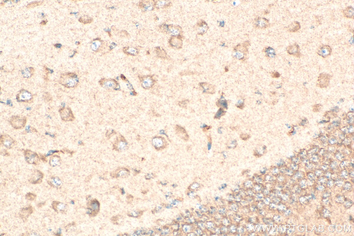 Immunohistochemistry (IHC) staining of mouse brain tissue using FN3KRP Polyclonal antibody (16312-1-AP)