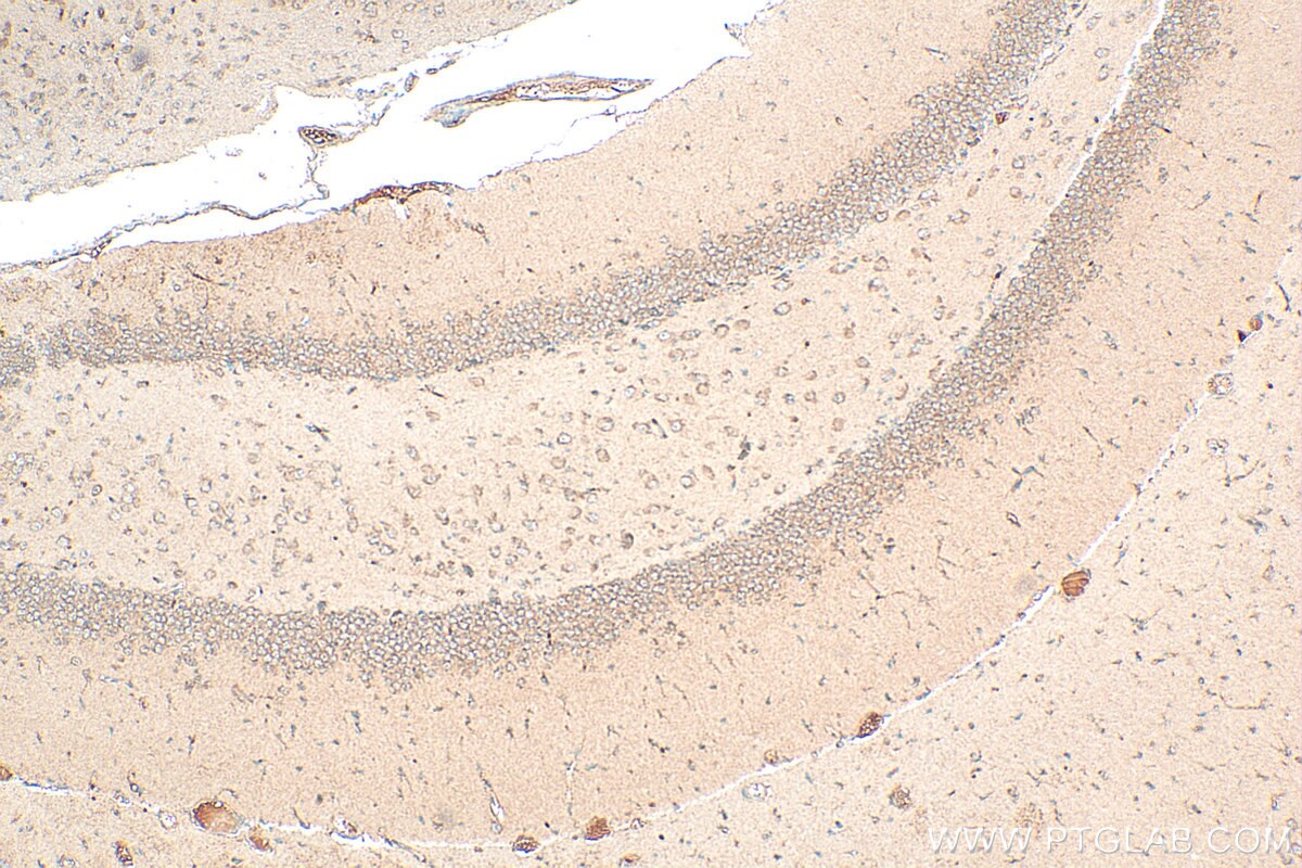Immunohistochemistry (IHC) staining of mouse brain tissue using FN3KRP Polyclonal antibody (16312-1-AP)