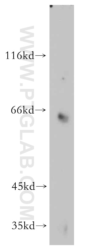 Western Blot (WB) analysis of mouse brain tissue using Toca 1 Polyclonal antibody (55055-1-AP)