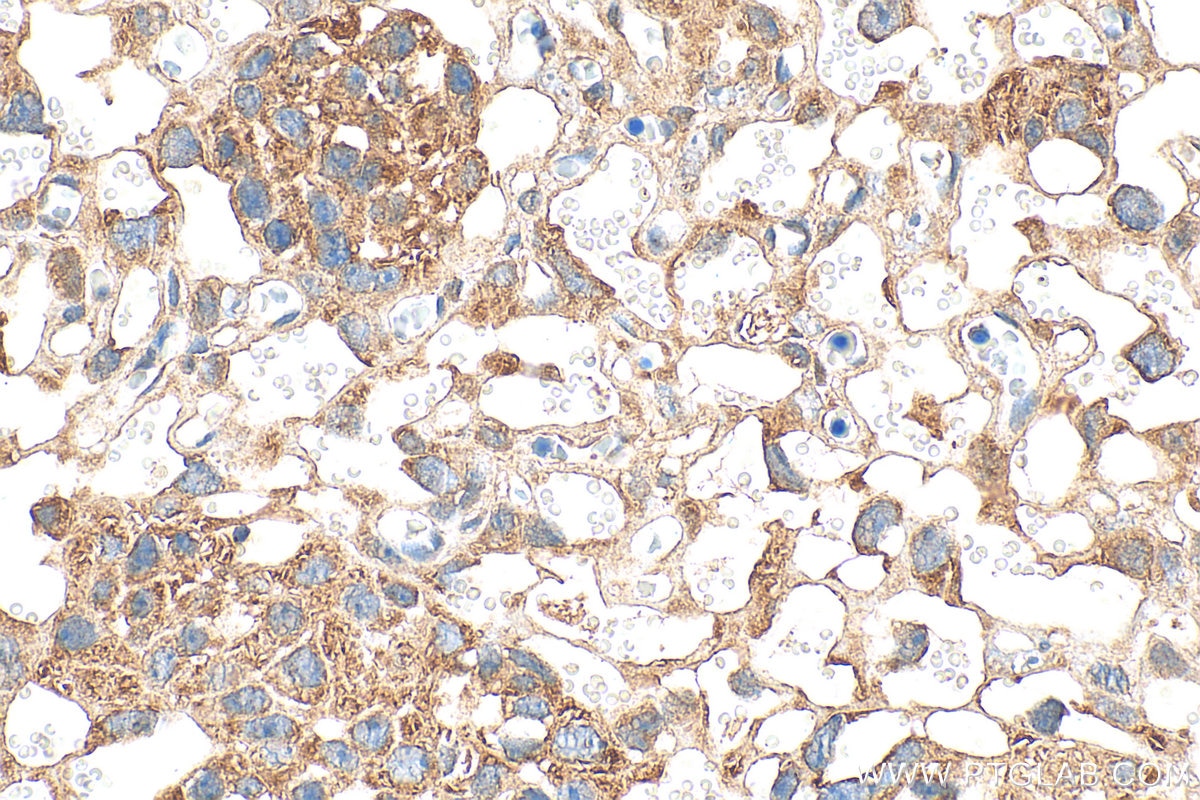Immunohistochemistry (IHC) staining of mouse placenta tissue using FNDC3A Polyclonal antibody (25240-1-AP)