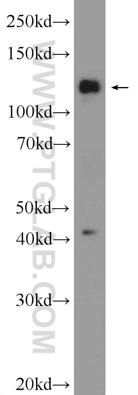 Western Blot (WB) analysis of HEK-293 cells using FNDC3A Polyclonal antibody (25240-1-AP)