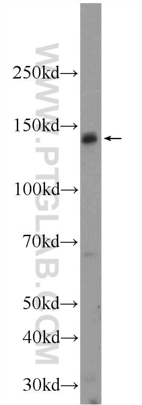 Western Blot (WB) analysis of mouse placenta tissue using FNDC3A Polyclonal antibody (25240-1-AP)