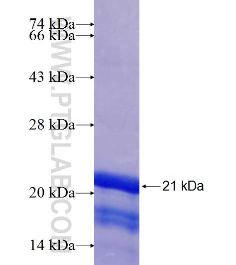 FNDC3A fusion protein Ag18911 SDS-PAGE