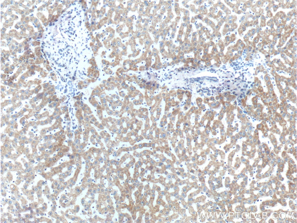 IHC staining of human liver using 22605-1-AP