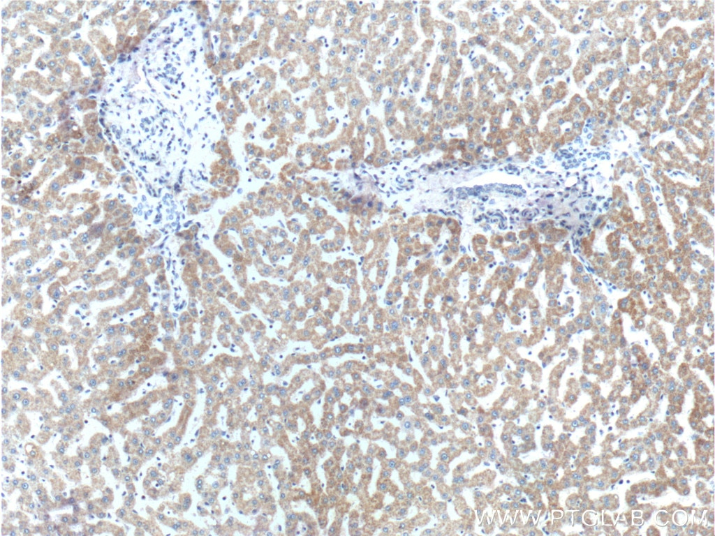 Immunohistochemistry (IHC) staining of human liver tissue using FNDC3B Polyclonal antibody (22605-1-AP)