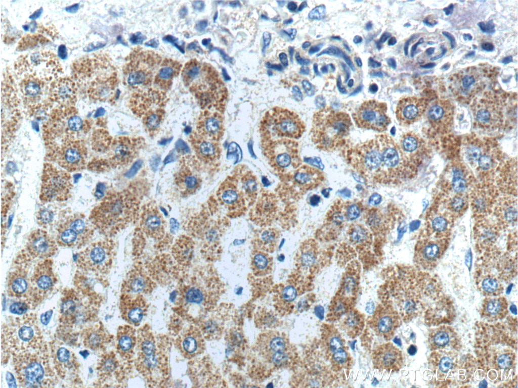 Immunohistochemistry (IHC) staining of human liver tissue using FNDC3B Polyclonal antibody (22605-1-AP)