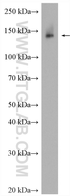 Western Blot (WB) analysis of 4T1 cells using FNDC3B Polyclonal antibody (22605-1-AP)