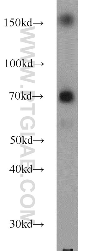 WB analysis of HL-60 using 22605-1-AP