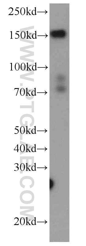 Western Blot (WB) analysis of HepG2 cells using FNDC3B Polyclonal antibody (22605-1-AP)