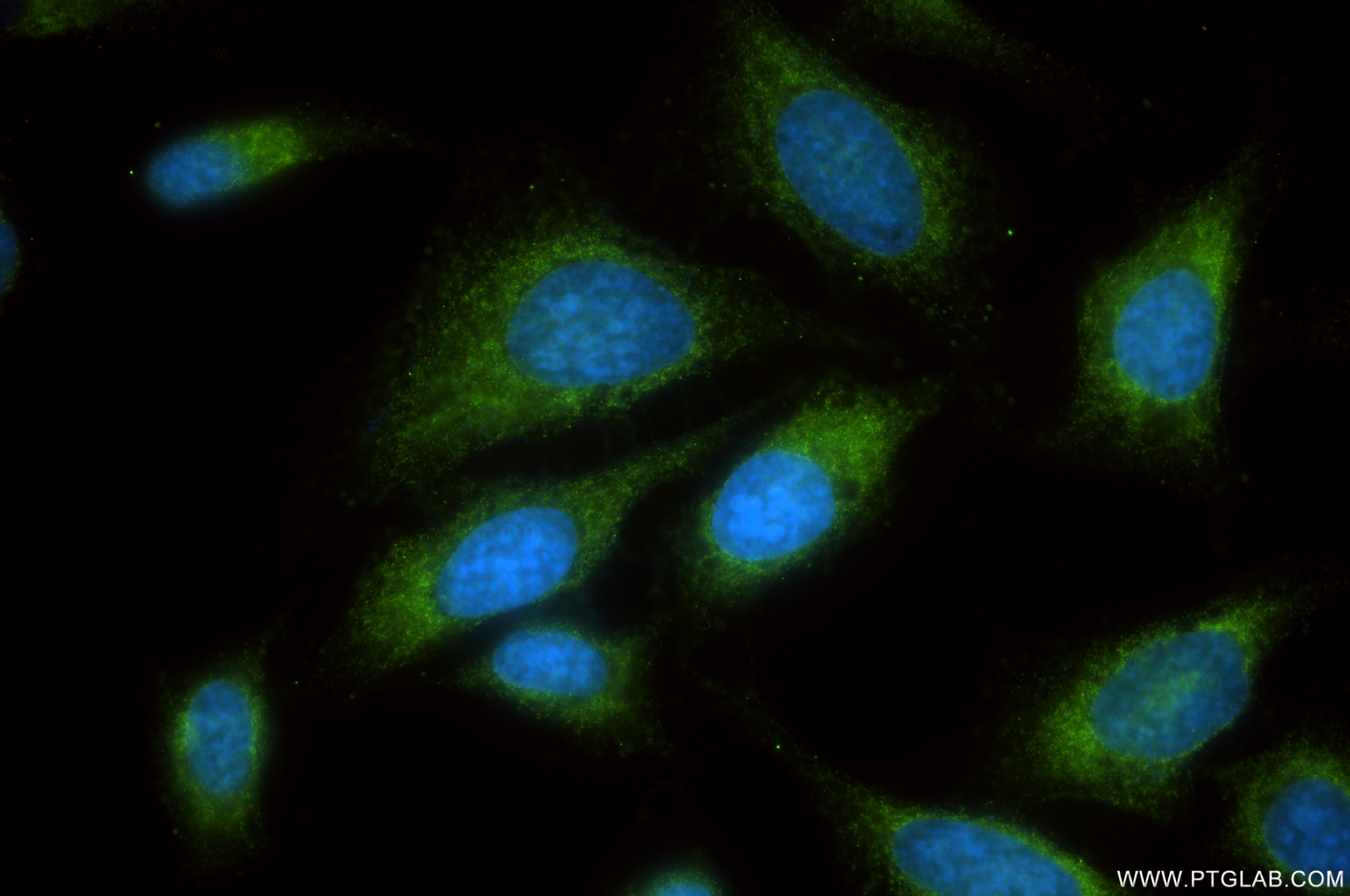 Immunofluorescence (IF) / fluorescent staining of HepG2 cells using FNDC3B Recombinant antibody (86272-1-RR)