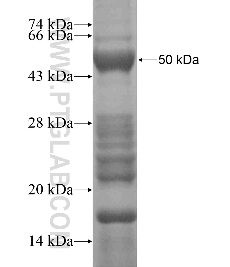 FNDC3B fusion protein Ag18357 SDS-PAGE