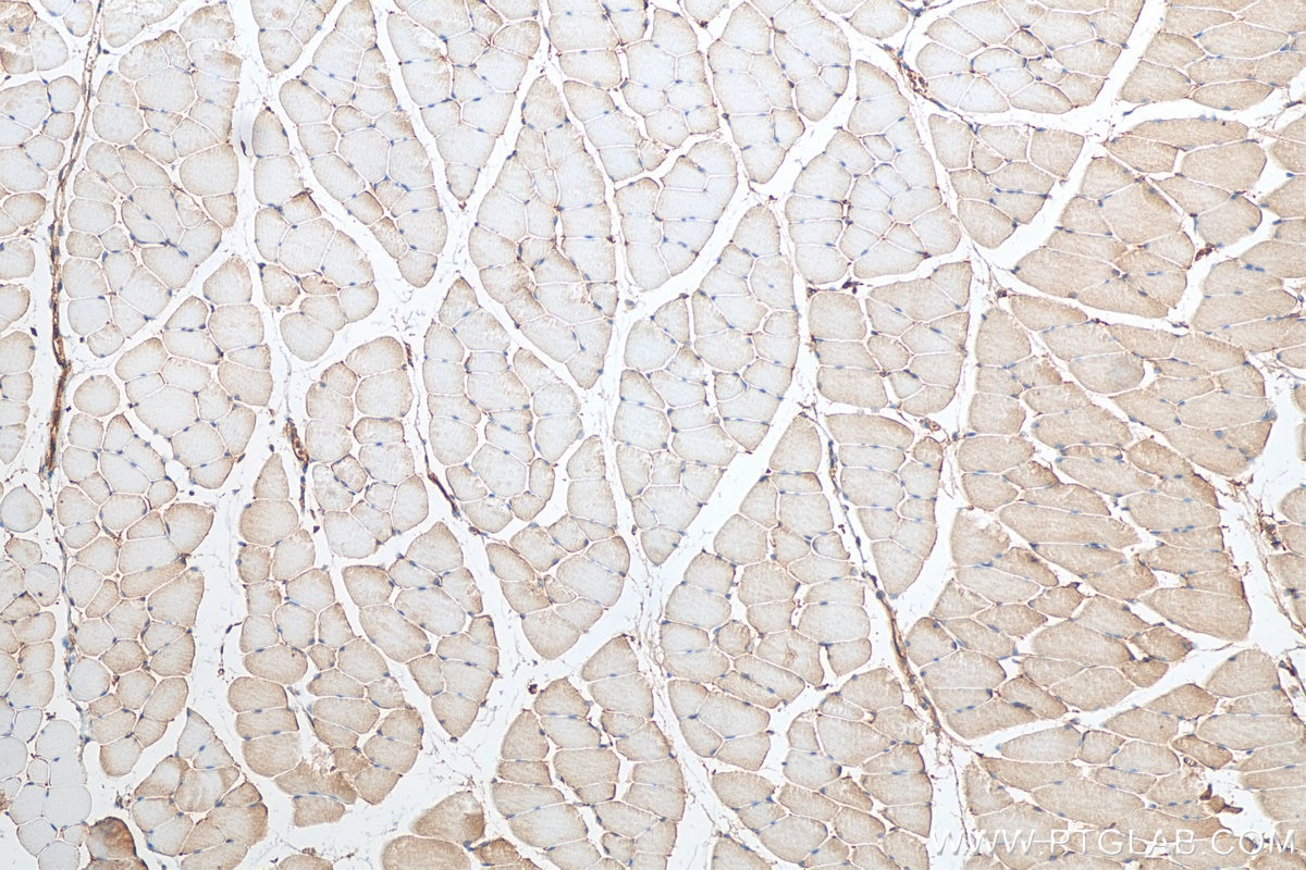 Immunohistochemistry (IHC) staining of mouse skeletal muscle tissue using FNDC5 Polyclonal antibody (23995-1-AP)