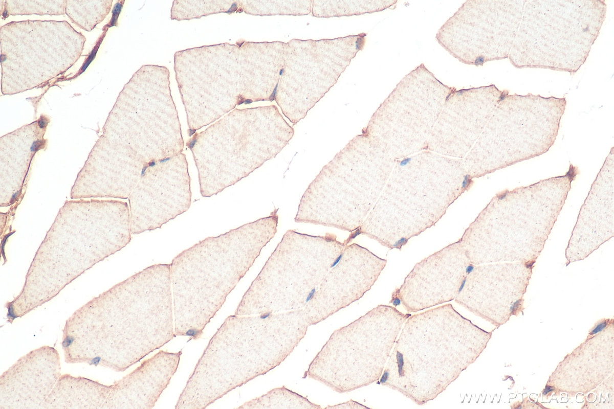 Immunohistochemistry (IHC) staining of mouse skeletal muscle tissue using FNDC5 Recombinant antibody (82671-1-RR)