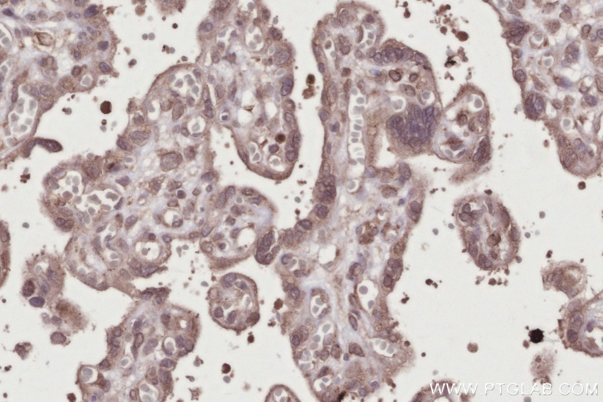 IHC staining of human placenta using 28380-1-AP Immunohistochemistry (IHC) staining of human placenta tissue using FNIP1 Polyclonal antibody (28380-1-AP)