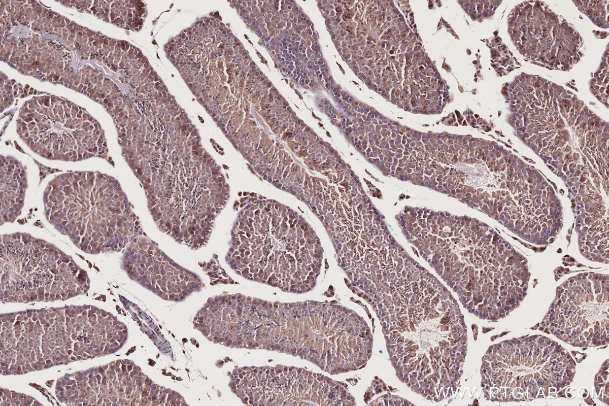 IHC staining of mouse testis using 28380-1-AP Immunohistochemistry (IHC) staining of mouse testis tissue using FNIP1 Polyclonal antibody (28380-1-AP)