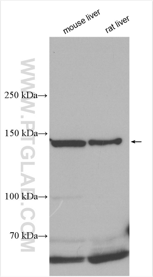 Western Blot (WB) analysis of various lysates using FNIP1 Polyclonal antibody (28380-1-AP)