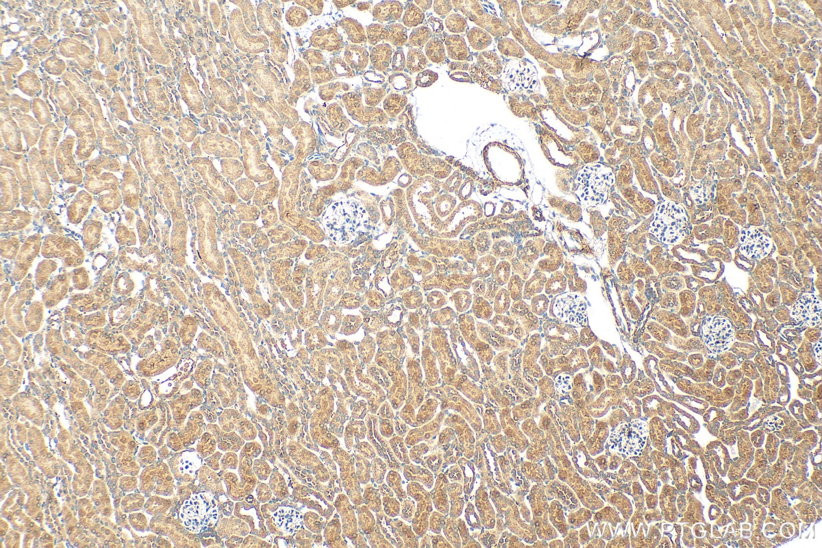 Immunohistochemistry (IHC) staining of mouse kidney tissue using FNIP2 Polyclonal antibody (31283-1-AP)