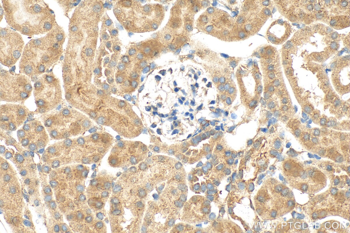 Immunohistochemistry (IHC) staining of mouse kidney tissue using FNIP2 Polyclonal antibody (31283-1-AP)