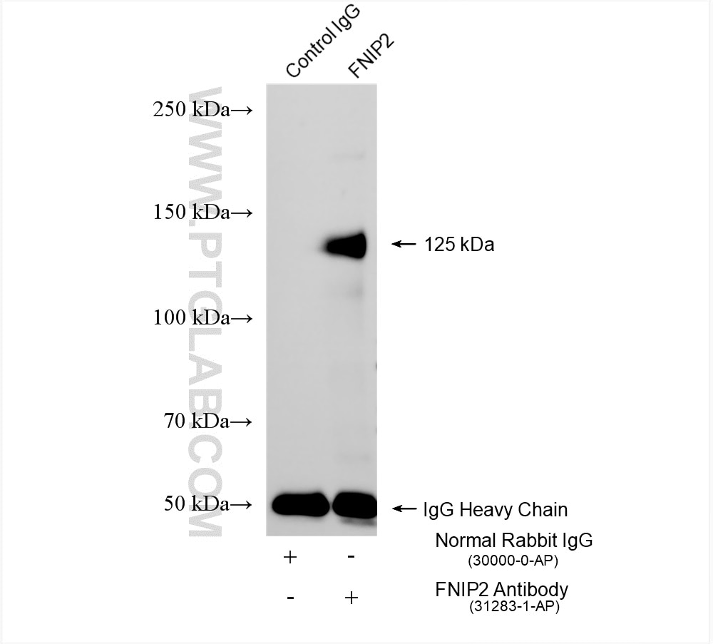 Immunoprecipitation (IP) experiment of HEK-293 cells using FNIP2 Polyclonal antibody (31283-1-AP)
