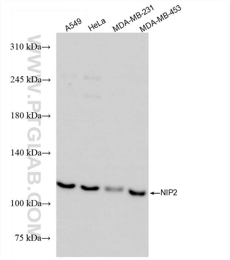Western Blot (WB) analysis of A549 cells using FNIP2 Recombinant antibody (84371-2-RR)