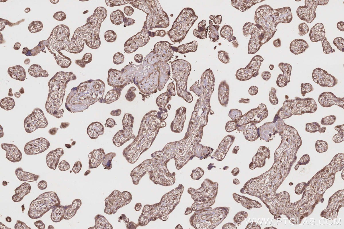 Immunohistochemistry (IHC) staining of human placenta tissue using FNTA Polyclonal antibody (12274-1-AP)