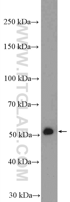 Western Blot (WB) analysis of mouse skin tissue using FNTB Polyclonal antibody (11507-1-AP)