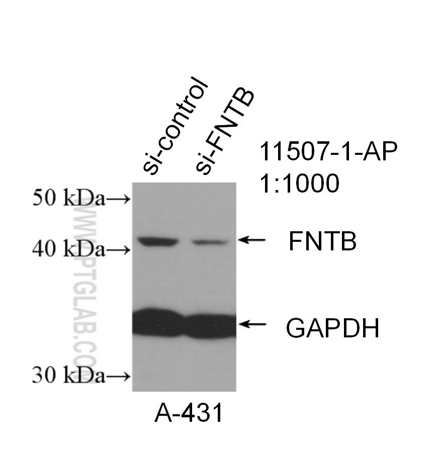 Western Blot (WB) analysis of A431 cells using FNTB Polyclonal antibody (11507-1-AP)