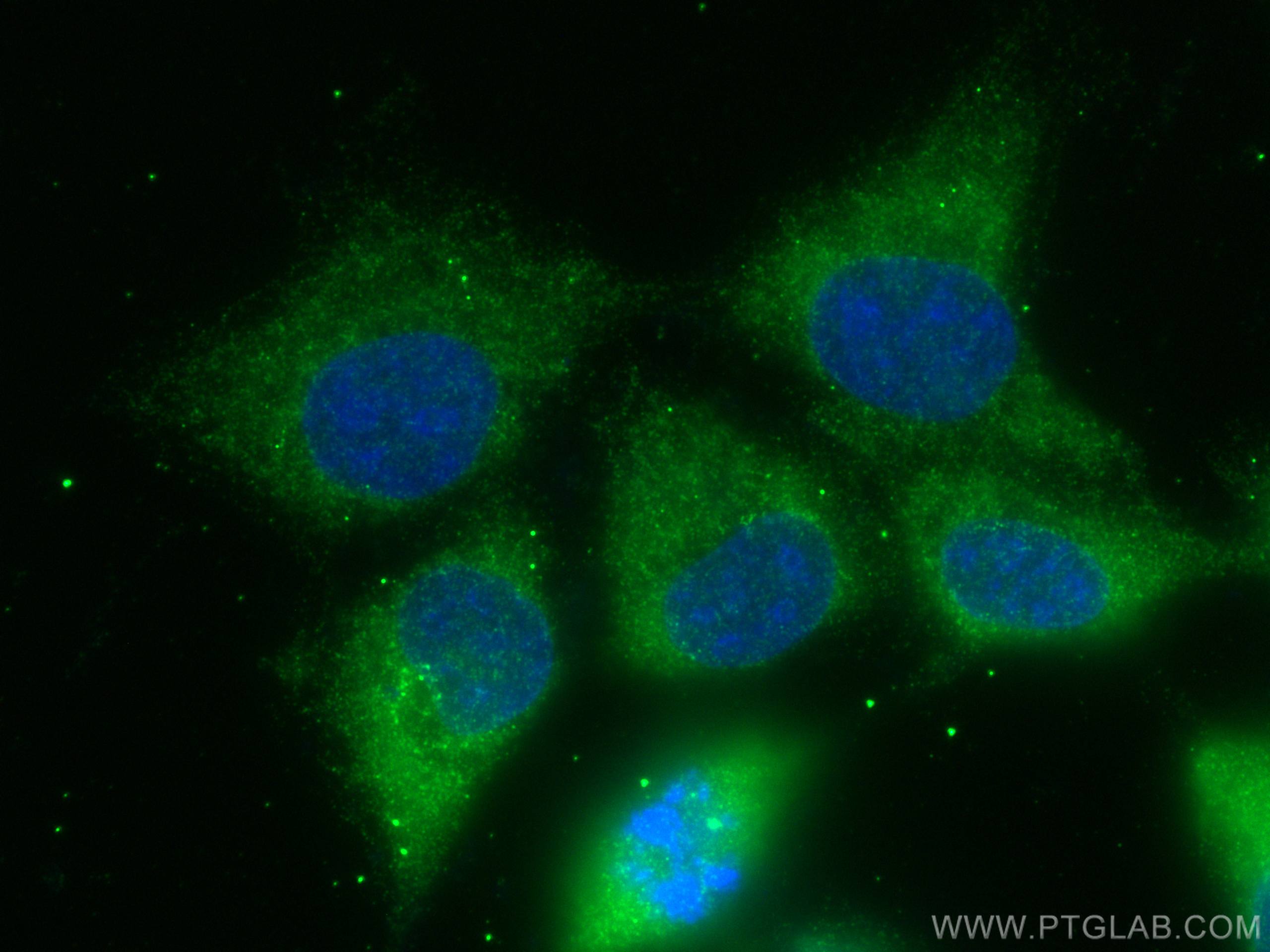 Immunofluorescence (IF) / fluorescent staining of A431 cells using FNTB Monoclonal antibody (66783-1-Ig)