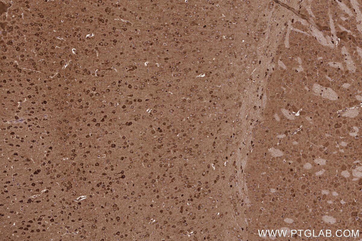 Immunohistochemistry (IHC) staining of mouse brain tissue using FNTB Monoclonal antibody (66783-1-Ig)