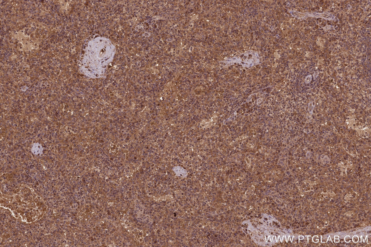 Immunohistochemistry (IHC) staining of human spleen tissue using FNTB Monoclonal antibody (66783-1-Ig)