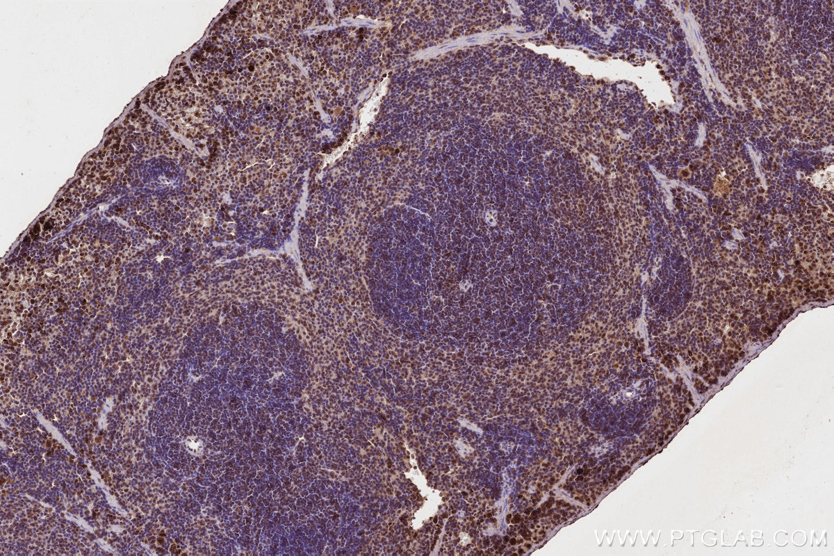 Immunohistochemistry (IHC) staining of mouse spleen tissue using FNTB Monoclonal antibody (66783-1-Ig)