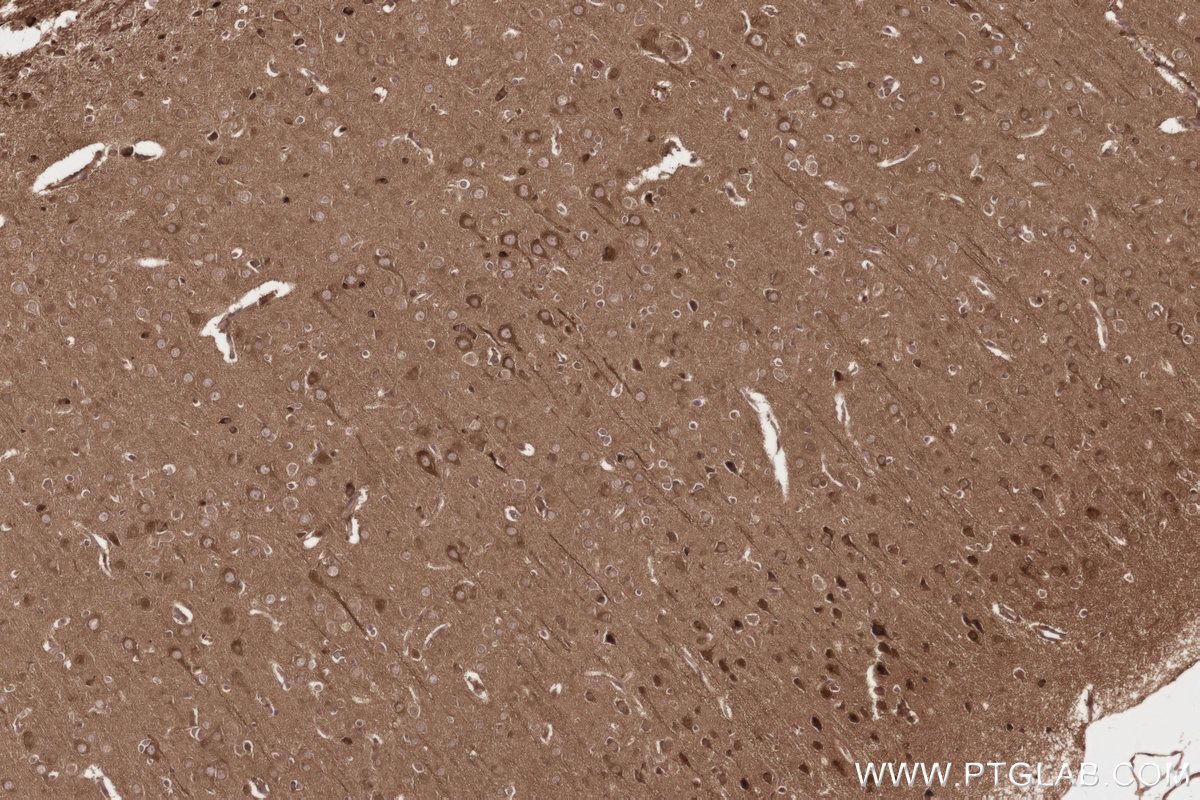 Immunohistochemistry (IHC) staining of rat brain tissue using FNTB Monoclonal antibody (66783-1-Ig)