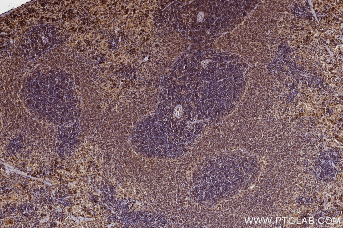Immunohistochemistry (IHC) staining of rat spleen tissue using FNTB Monoclonal antibody (66783-1-Ig)