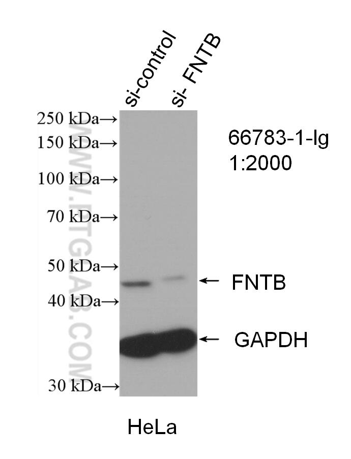 Western Blot (WB) analysis of HeLa cells using FNTB Monoclonal antibody (66783-1-Ig)