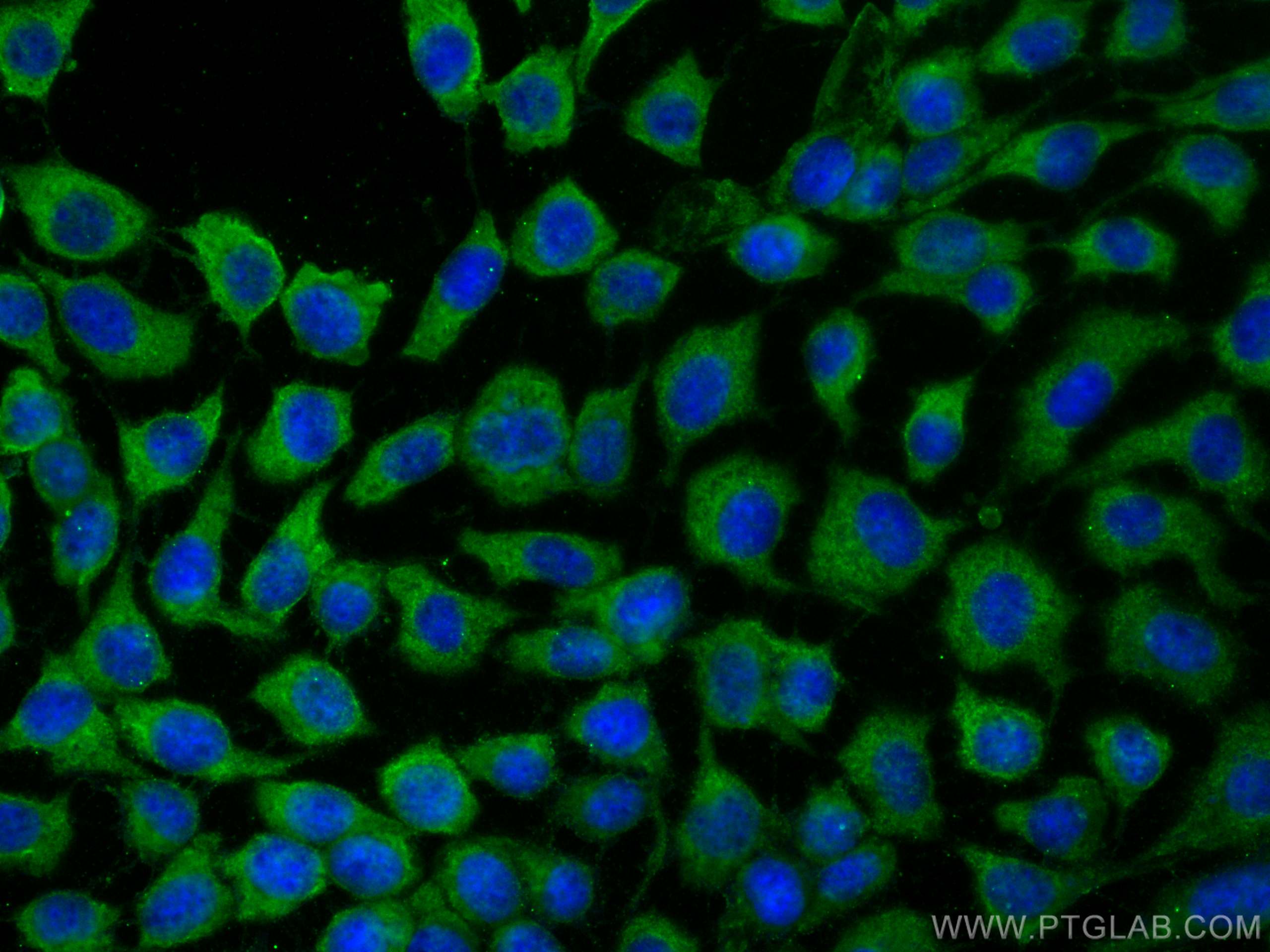 Immunofluorescence (IF) / fluorescent staining of A431 cells using CoraLite® Plus 488-conjugated FNTB Monoclonal anti (CL488-66783)