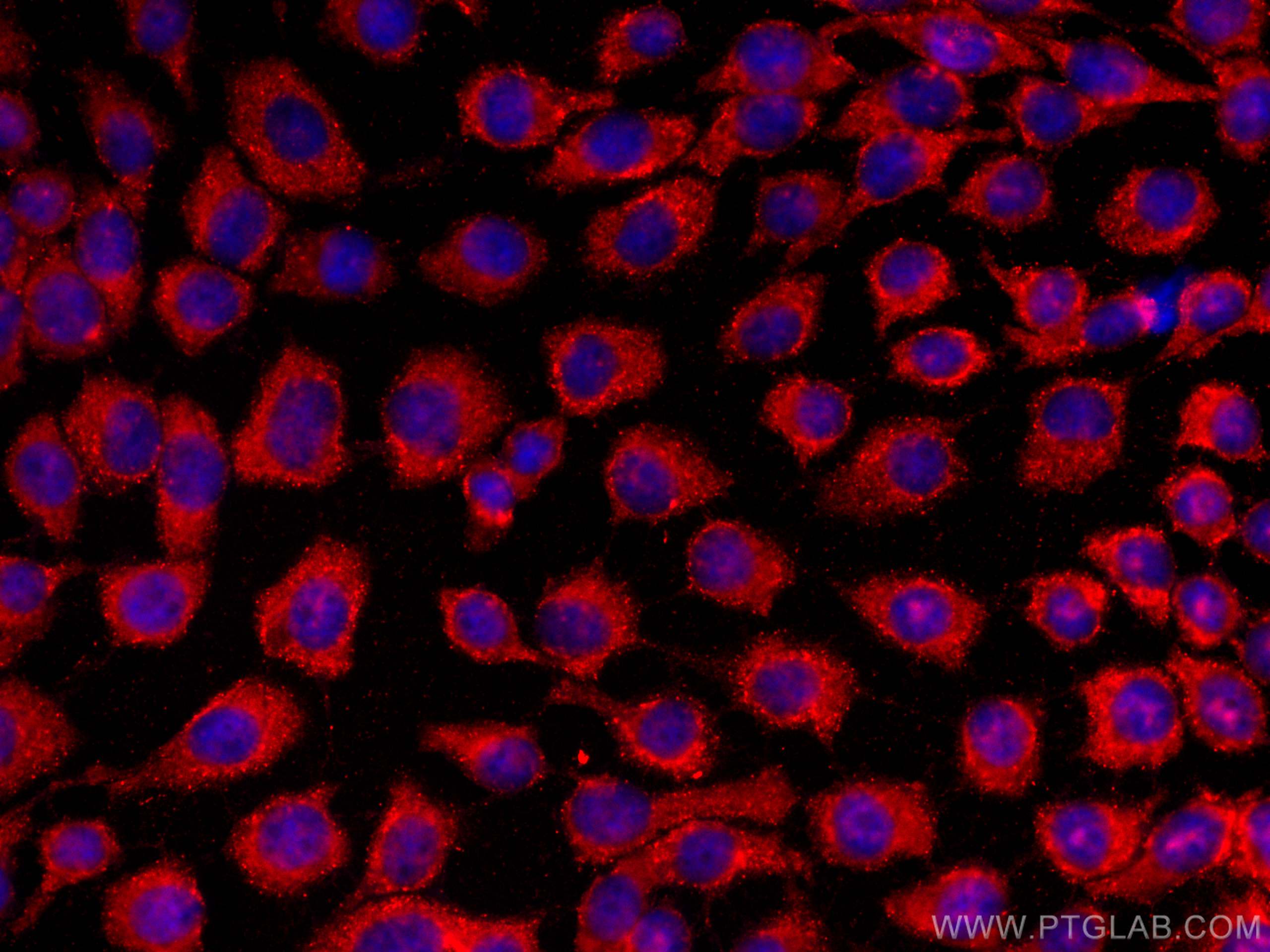 Immunofluorescence (IF) / fluorescent staining of A431 cells using CoraLite®594-conjugated FNTB Monoclonal antibody (CL594-66783)