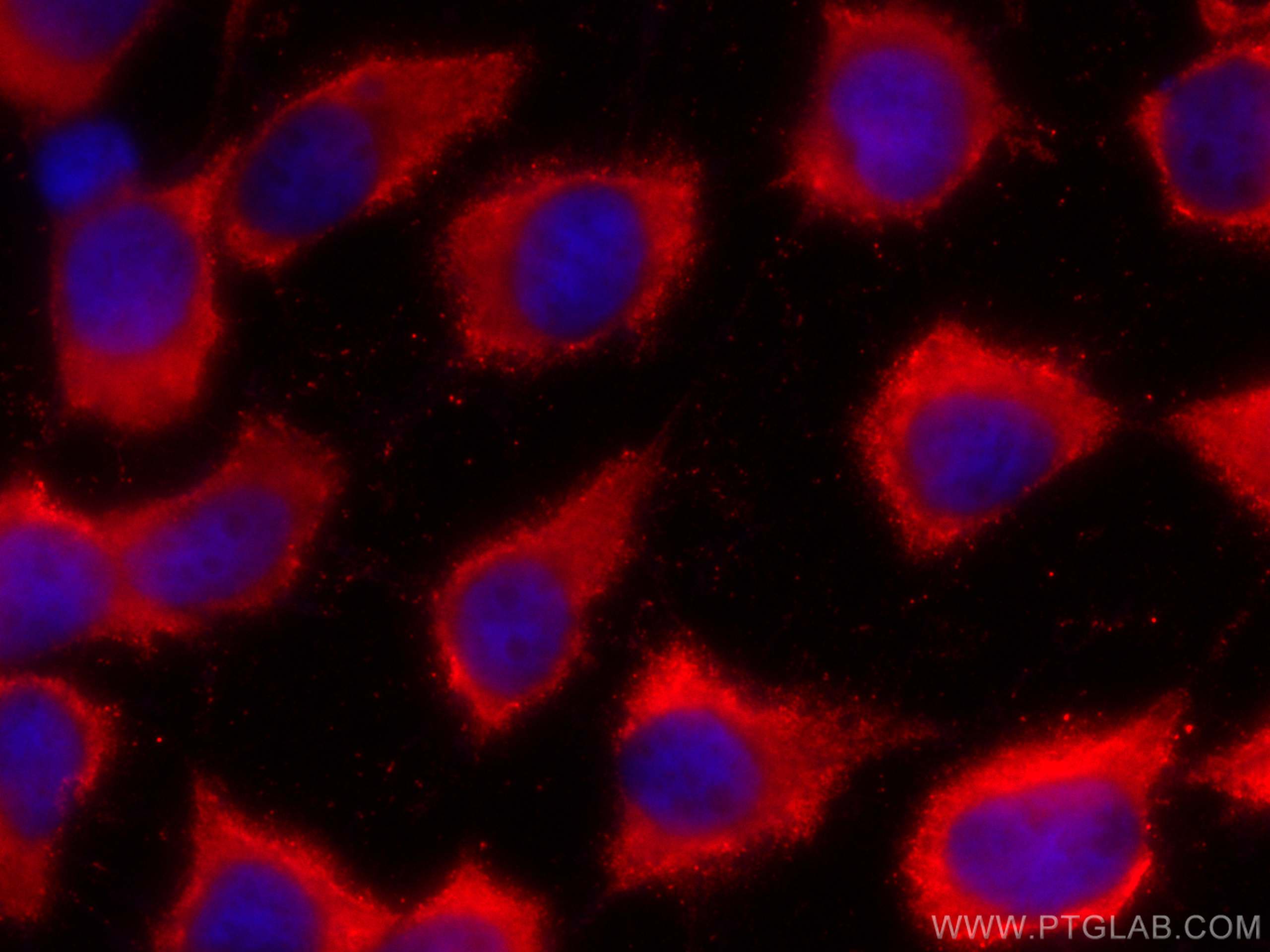 Immunofluorescence (IF) / fluorescent staining of A431 cells using CoraLite®594-conjugated FNTB Monoclonal antibody (CL594-66783)