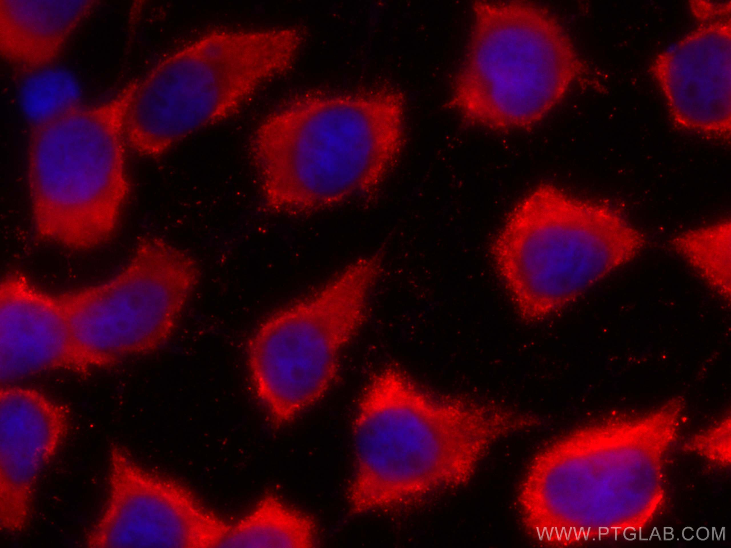 IF Staining of A431 using CL594-66783