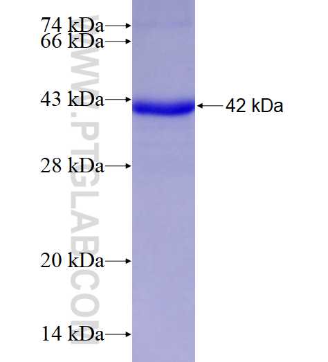 FNTB fusion protein Ag27796 SDS-PAGE