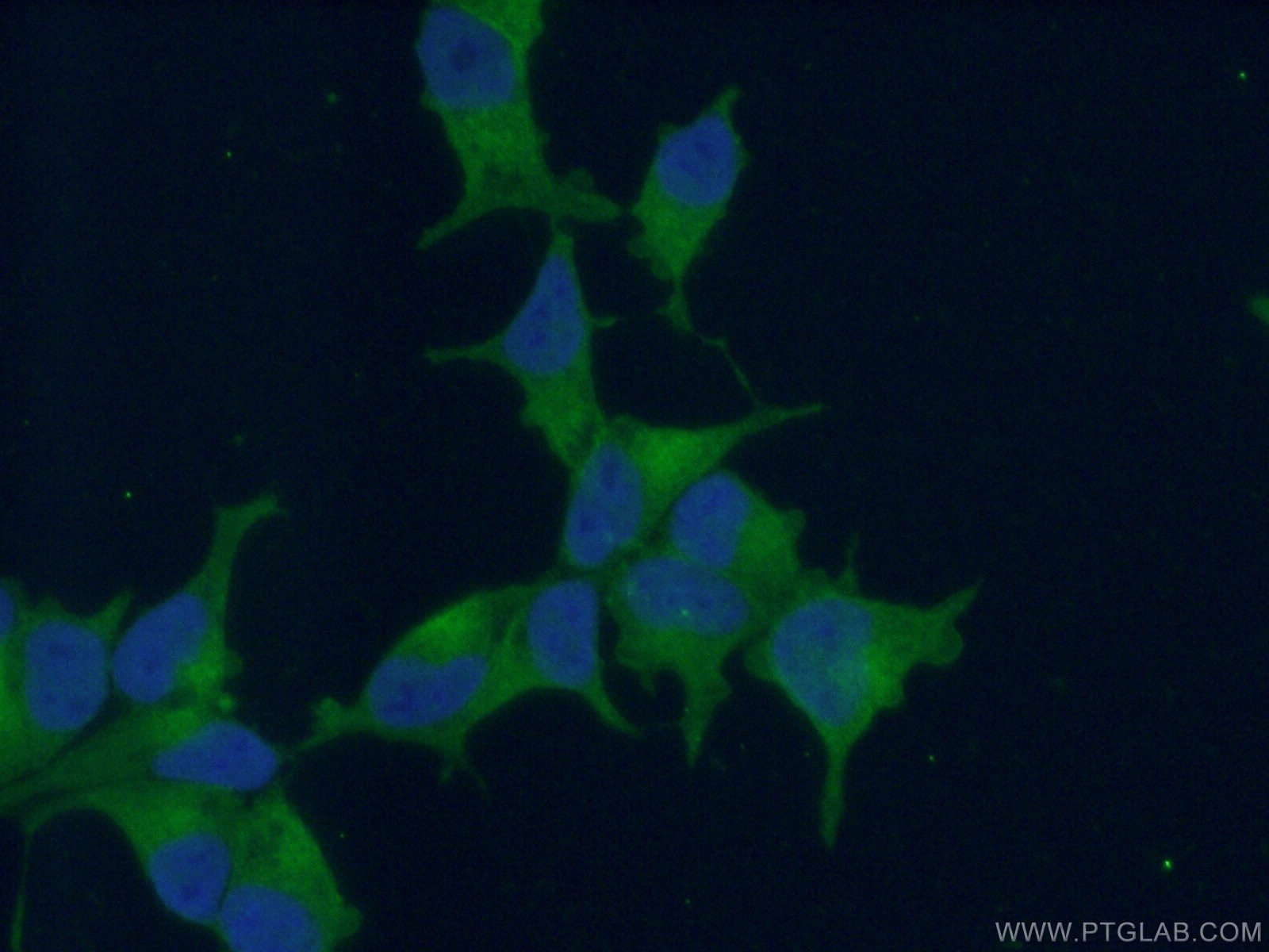 Immunofluorescence (IF) / fluorescent staining of LNCaP cells using PSMA/GCPII Polyclonal antibody (13163-1-AP)