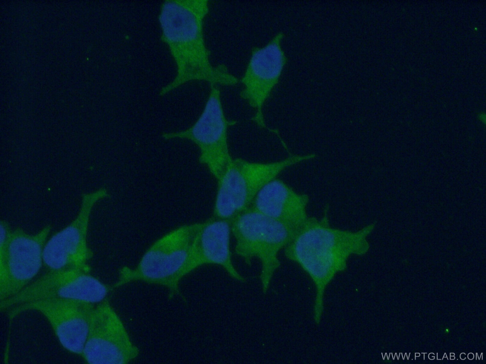 IF Staining of LNCaP using 13163-1-AP