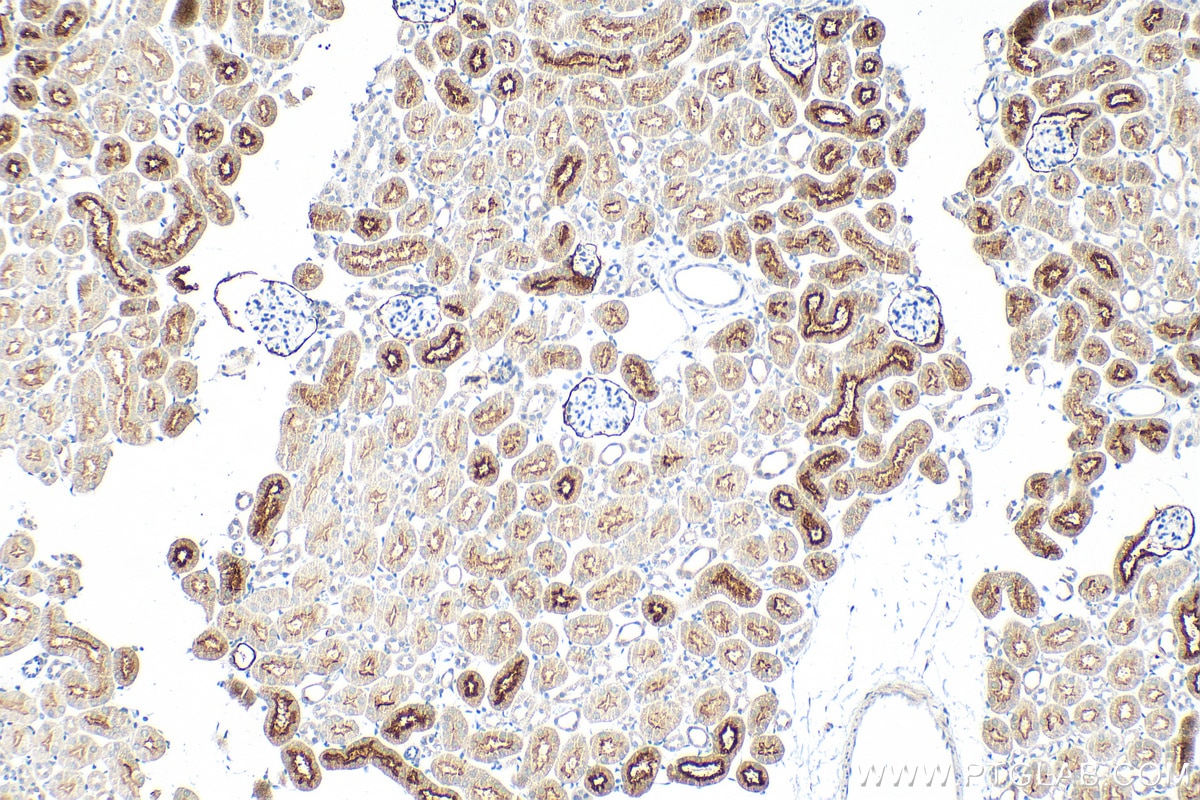 Immunohistochemistry (IHC) staining of mouse kidney tissue using PSMA/GCPII Polyclonal antibody (13163-1-AP)