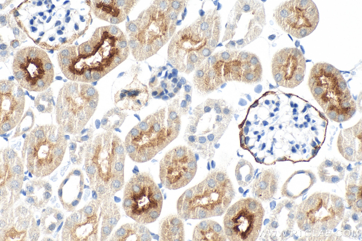 Immunohistochemistry (IHC) staining of mouse kidney tissue using PSMA/GCPII Polyclonal antibody (13163-1-AP)