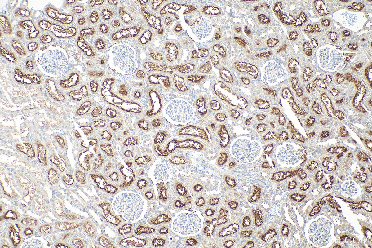 Immunohistochemistry (IHC) staining of rat kidney tissue using PSMA/GCPII Polyclonal antibody (13163-1-AP)