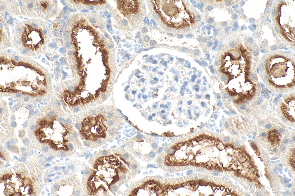 Immunohistochemistry (IHC) staining of rat kidney tissue using PSMA/GCPII Polyclonal antibody (13163-1-AP)