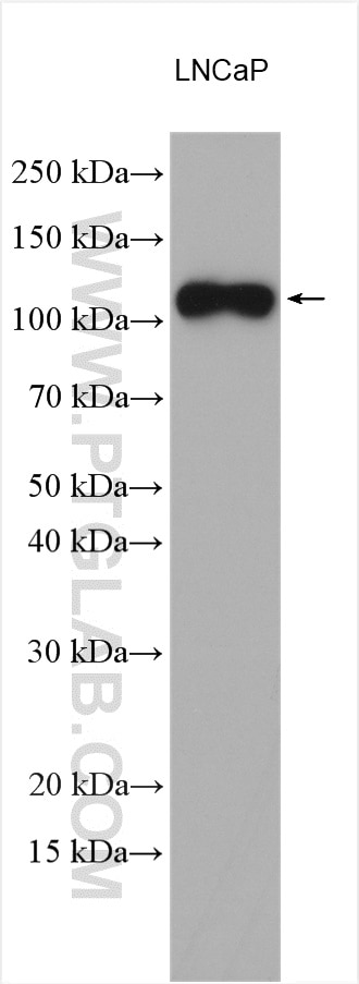 Western Blot (WB) analysis of various lysates using PSMA/GCPII Polyclonal antibody (13163-1-AP)
