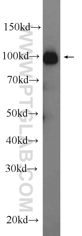 Western Blot (WB) analysis of rat kidney tissue using PSMA/GCPII Polyclonal antibody (13163-1-AP)
