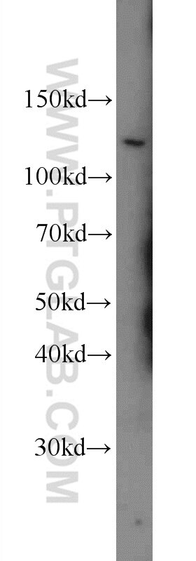 WB analysis of PC-3 using 13163-1-AP