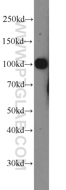 Western Blot (WB) analysis of mouse kidney tissue using PSMA/GCPII Polyclonal antibody (13163-1-AP)